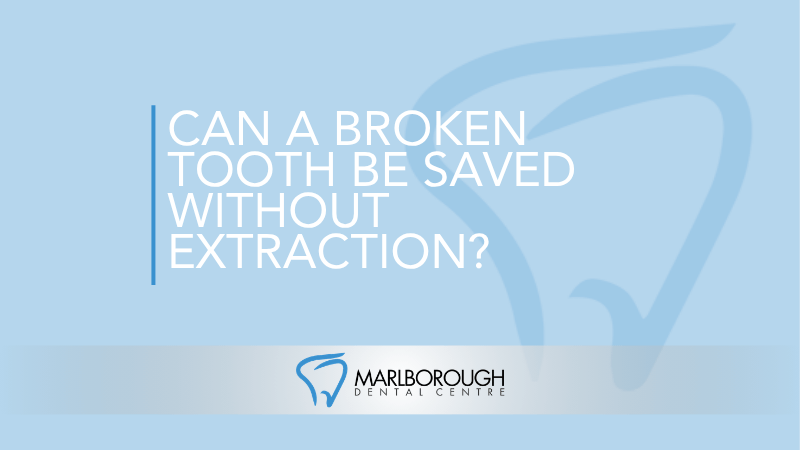 Can a Broken Tooth Be Saved Without Extraction?
